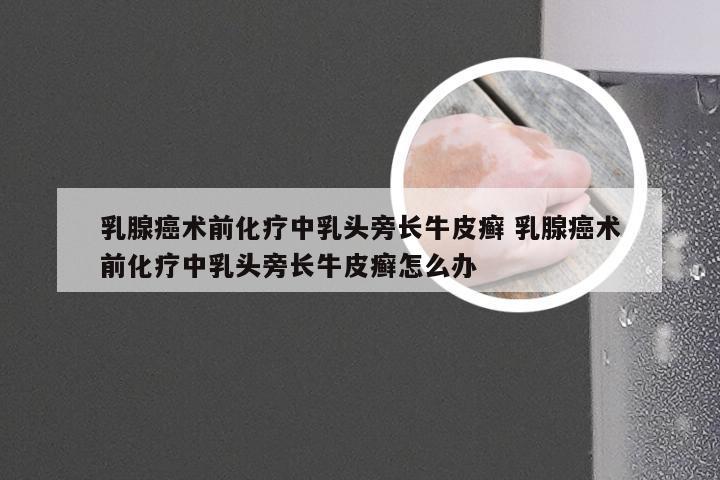 乳腺癌术前化疗中乳头旁长牛皮癣 乳腺癌术前化疗中乳头旁长牛皮癣怎么办
