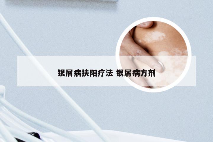 银屑病扶阳疗法 银屑病方剂