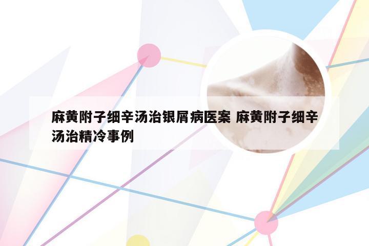 麻黄附子细辛汤治银屑病医案 麻黄附子细辛汤治精冷事例