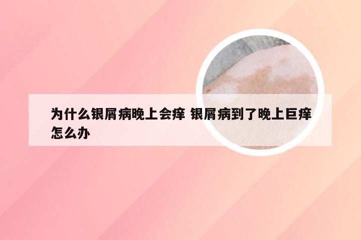 为什么银屑病晚上会痒 银屑病到了晚上巨痒怎么办