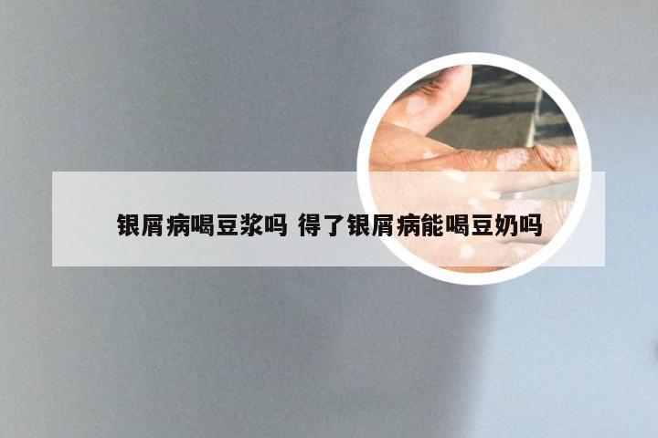 银屑病喝豆浆吗 得了银屑病能喝豆奶吗