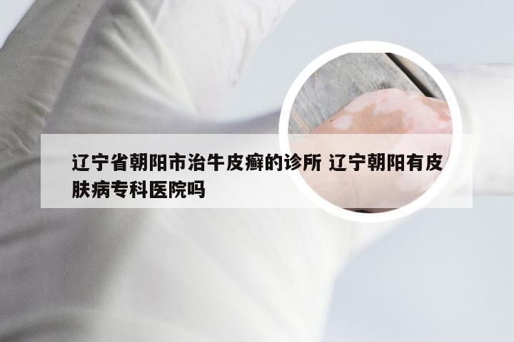 辽宁省朝阳市治牛皮癣的诊所 辽宁朝阳有皮肤病专科医院吗