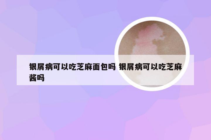 银屑病可以吃芝麻面包吗 银屑病可以吃芝麻酱吗