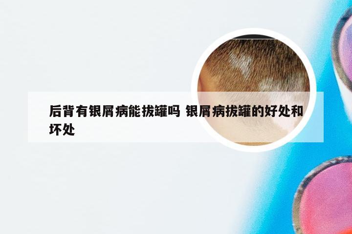 后背有银屑病能拔罐吗 银屑病拔罐的好处和坏处