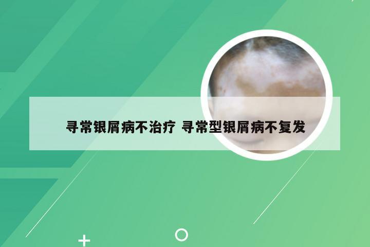 寻常银屑病不治疗 寻常型银屑病不复发