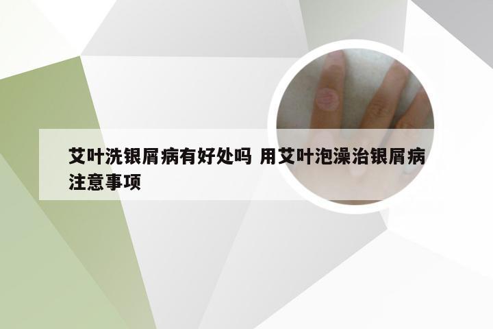 艾叶洗银屑病有好处吗 用艾叶泡澡治银屑病注意事项