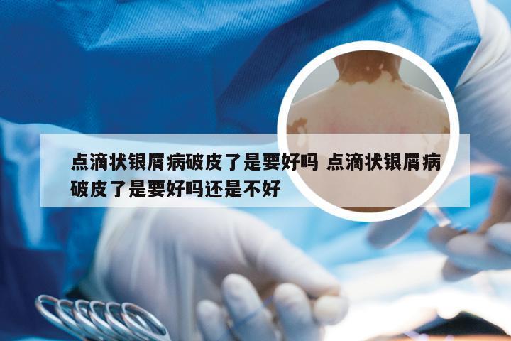 点滴状银屑病破皮了是要好吗 点滴状银屑病破皮了是要好吗还是不好