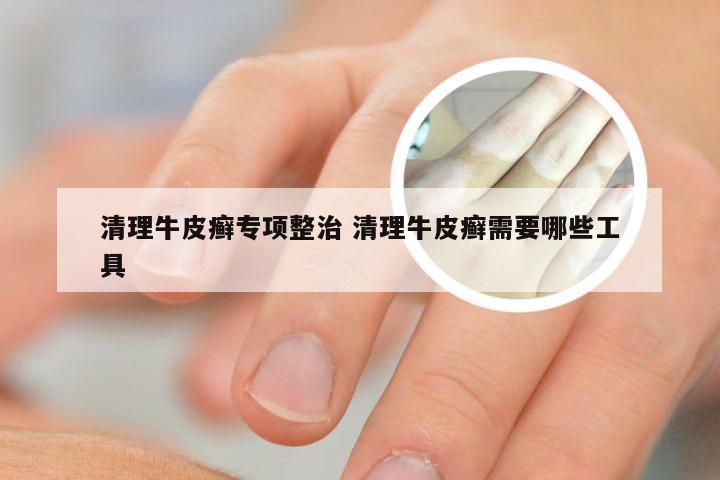 清理牛皮癣专项整治 清理牛皮癣需要哪些工具