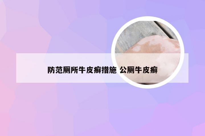 防范厕所牛皮癣措施 公厕牛皮癣