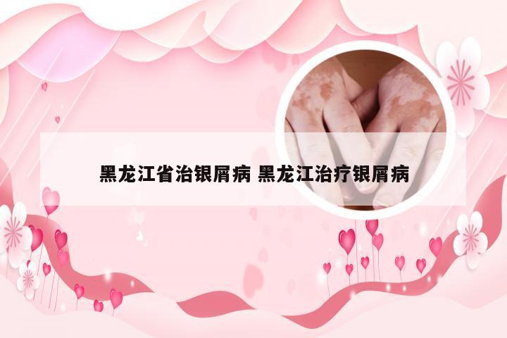 黑龙江省治银屑病 黑龙江治疗银屑病