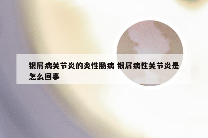 银屑病关节炎的炎性肠病 银屑病性关节炎是怎么回事