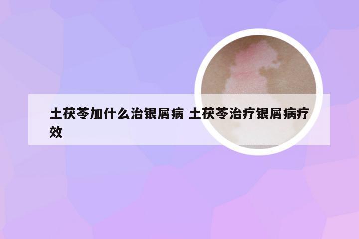 土茯苓加什么治银屑病 土茯苓治疗银屑病疗效