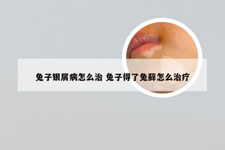 兔子银屑病怎么治 兔子得了兔藓怎么治疗
