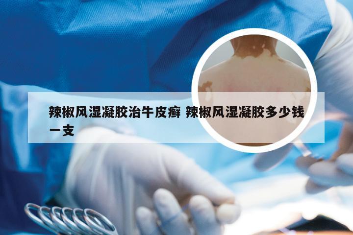 辣椒风湿凝胶治牛皮癣 辣椒风湿凝胶多少钱一支