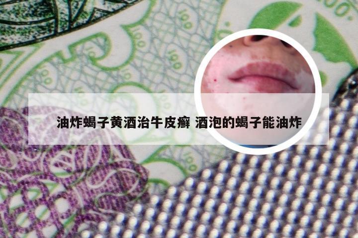 油炸蝎子黄酒治牛皮癣 酒泡的蝎子能油炸