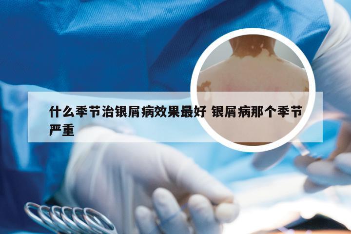 什么季节治银屑病效果最好 银屑病那个季节严重