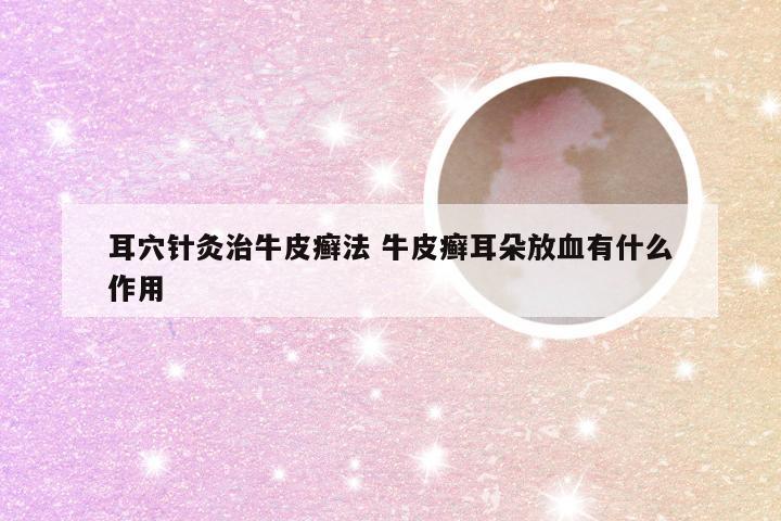 耳穴针灸治牛皮癣法 牛皮癣耳朵放血有什么作用