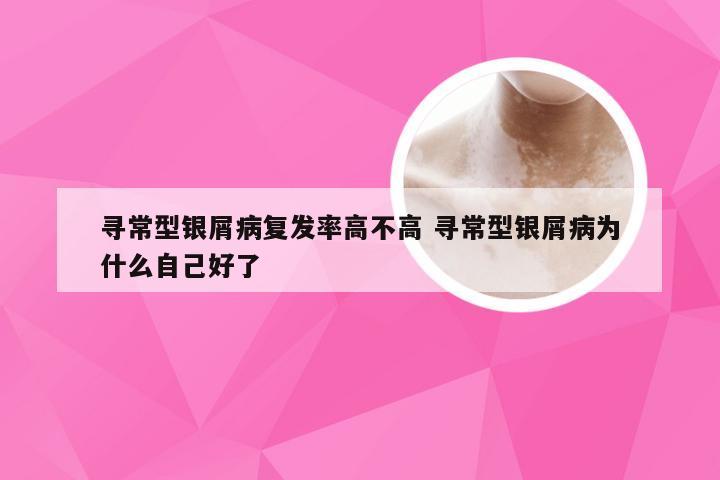 寻常型银屑病复发率高不高 寻常型银屑病为什么自己好了