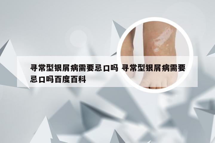 寻常型银屑病需要忌口吗 寻常型银屑病需要忌口吗百度百科