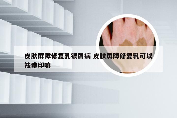 皮肤屏障修复乳银屑病 皮肤屏障修复乳可以祛痘印嘛