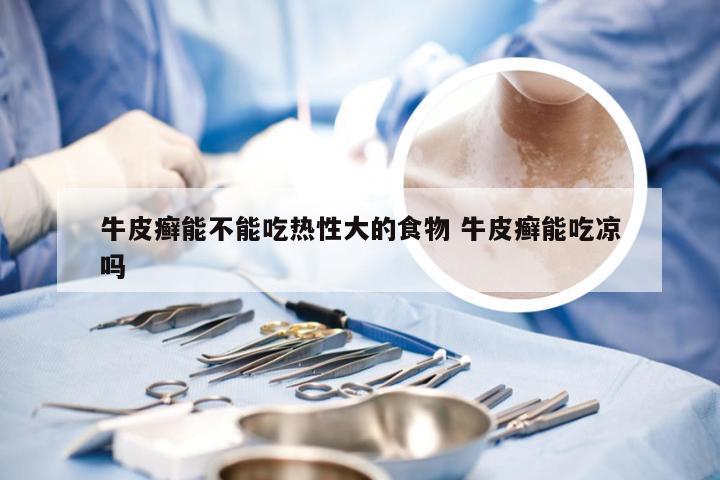 牛皮癣能不能吃热性大的食物 牛皮癣能吃凉吗