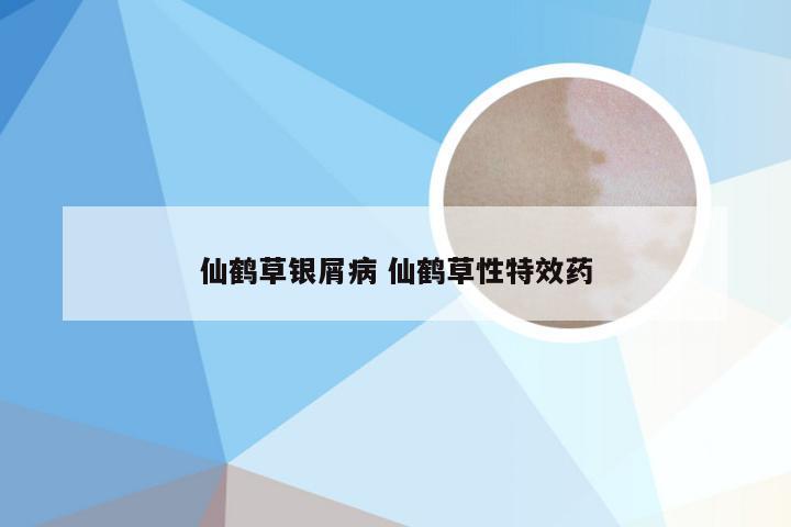 仙鹤草银屑病 仙鹤草性特效药