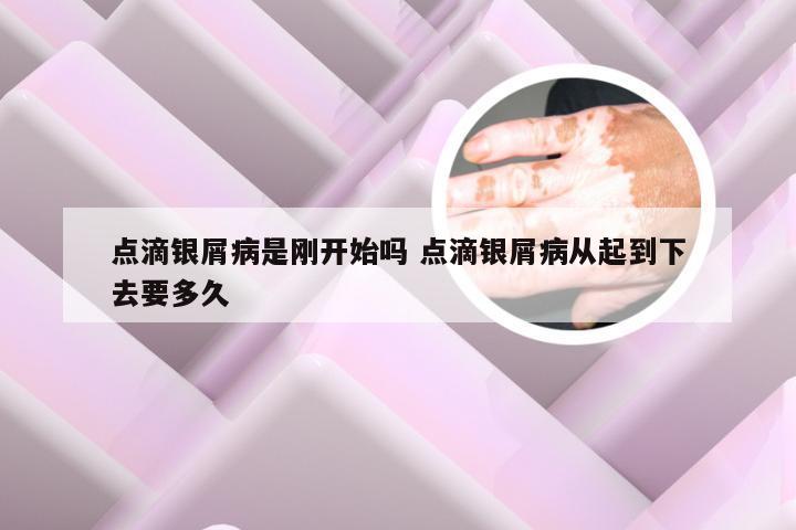 点滴银屑病是刚开始吗 点滴银屑病从起到下去要多久