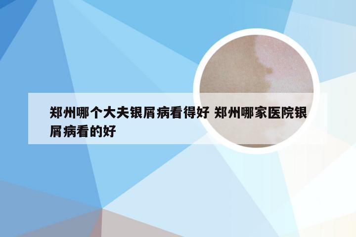 郑州哪个大夫银屑病看得好 郑州哪家医院银屑病看的好