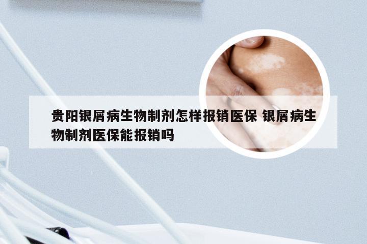 贵阳银屑病生物制剂怎样报销医保 银屑病生物制剂医保能报销吗