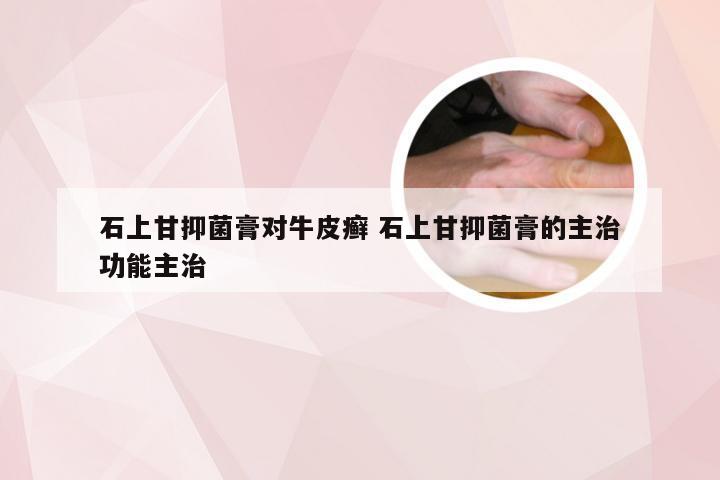 石上甘抑菌膏对牛皮癣 石上甘抑菌膏的主治功能主治