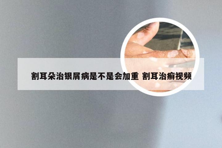 割耳朵治银屑病是不是会加重 割耳治癣视频