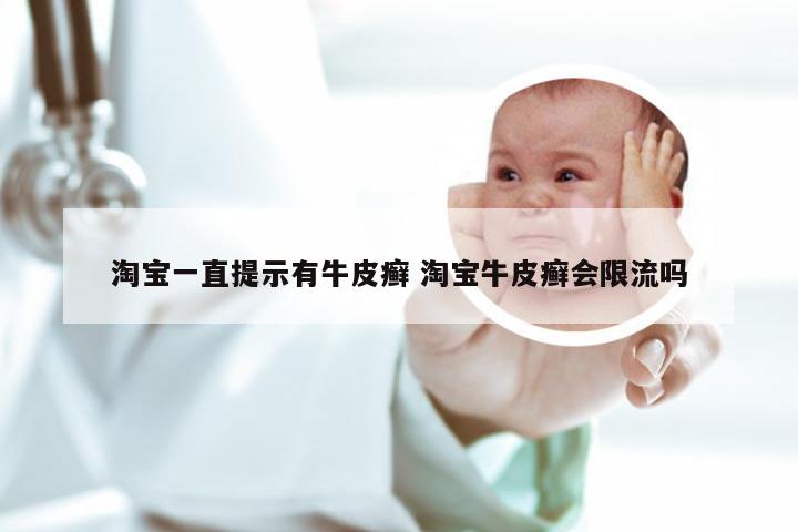 淘宝一直提示有牛皮癣 淘宝牛皮癣会限流吗
