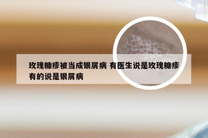 玫瑰糠疹被当成银屑病 有医生说是玫瑰糠疹有的说是银屑病