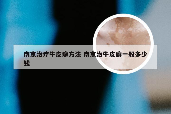 南京治疗牛皮癣方法 南京治牛皮癣一般多少钱