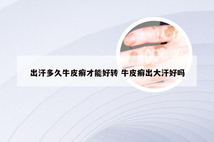 出汗多久牛皮癣才能好转 牛皮癣出大汗好吗