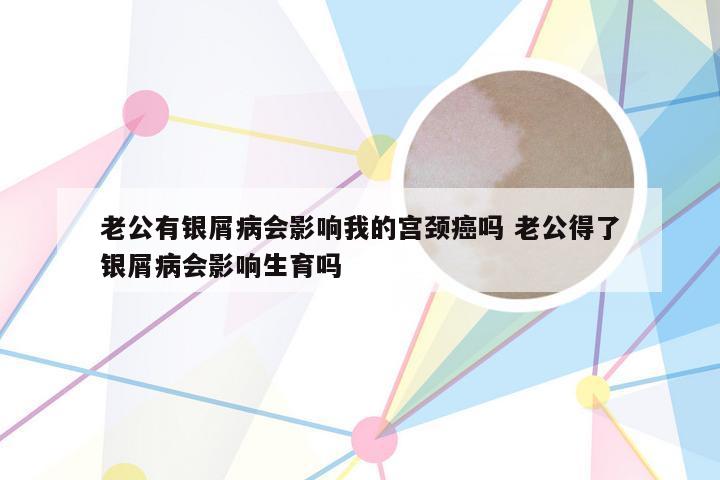 老公有银屑病会影响我的宫颈癌吗 老公得了银屑病会影响生育吗