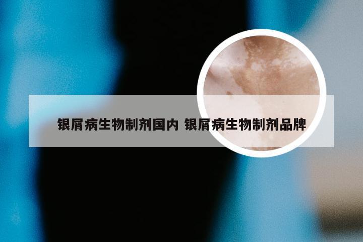 银屑病生物制剂国内 银屑病生物制剂品牌