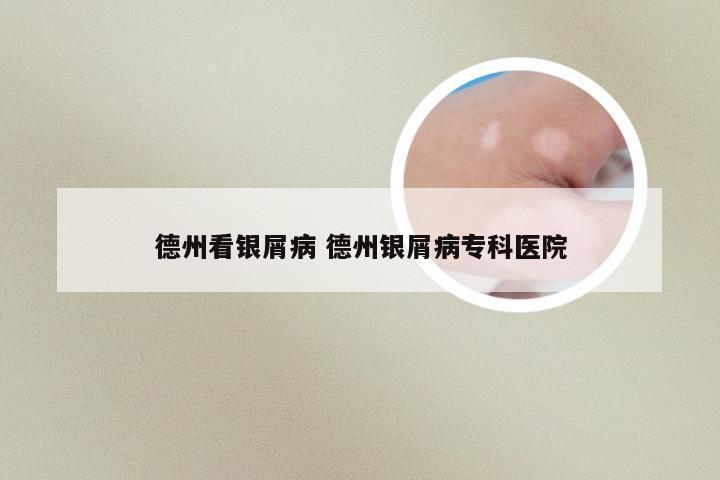 德州看银屑病 德州银屑病专科医院