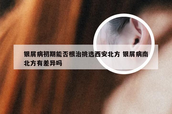 银屑病初期能否根治挑选西安北方 银屑病南北方有差异吗