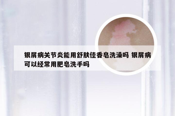 银屑病关节炎能用舒肤佳香皂洗澡吗 银屑病可以经常用肥皂洗手吗