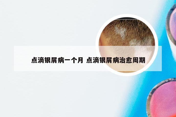 点滴银屑病一个月 点滴银屑病治愈周期