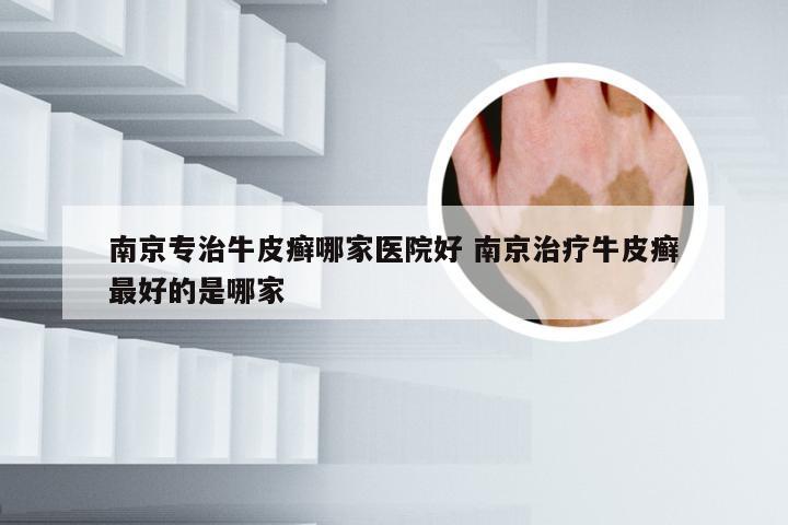 南京专治牛皮癣哪家医院好 南京治疗牛皮癣最好的是哪家