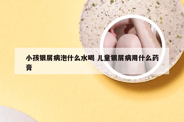 小孩银屑病泡什么水喝 儿童银屑病用什么药膏