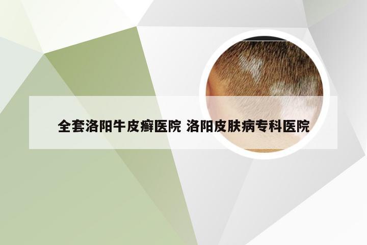 全套洛阳牛皮癣医院 洛阳皮肤病专科医院