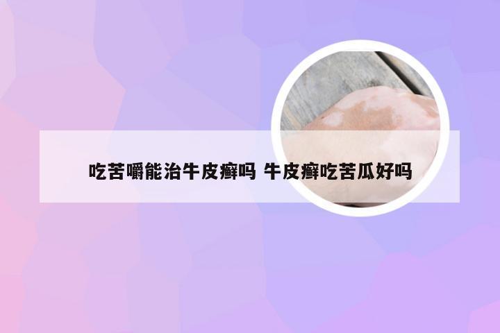 吃苦嚼能治牛皮癣吗 牛皮癣吃苦瓜好吗