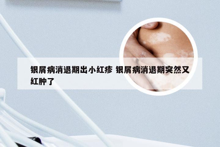 银屑病消退期出小红疹 银屑病消退期突然又红肿了