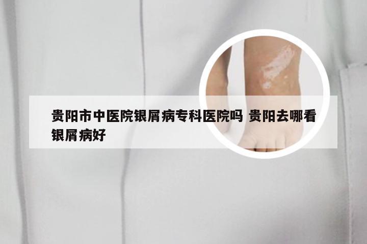 贵阳市中医院银屑病专科医院吗 贵阳去哪看银屑病好