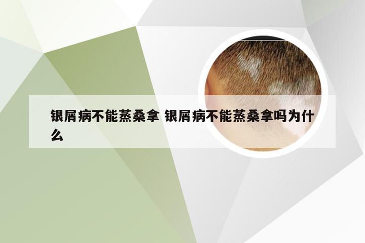银屑病不能蒸桑拿 银屑病不能蒸桑拿吗为什么