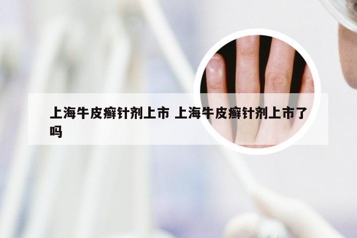 上海牛皮癣针剂上市 上海牛皮癣针剂上市了吗