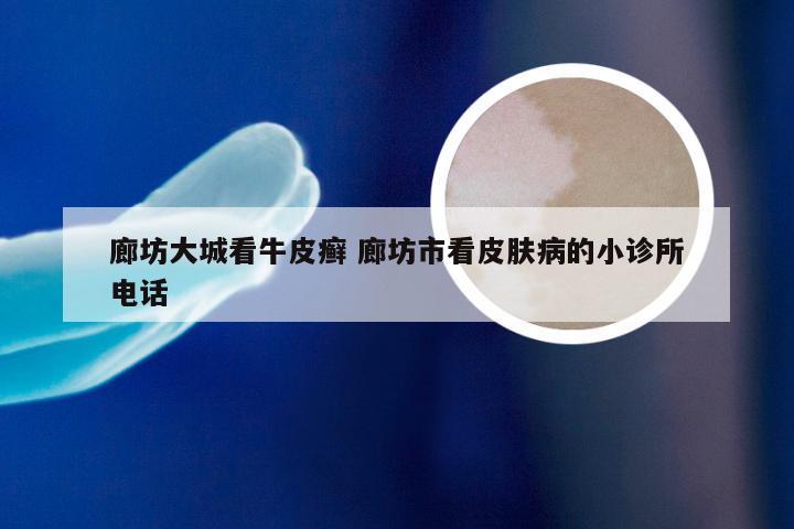廊坊大城看牛皮癣 廊坊市看皮肤病的小诊所电话